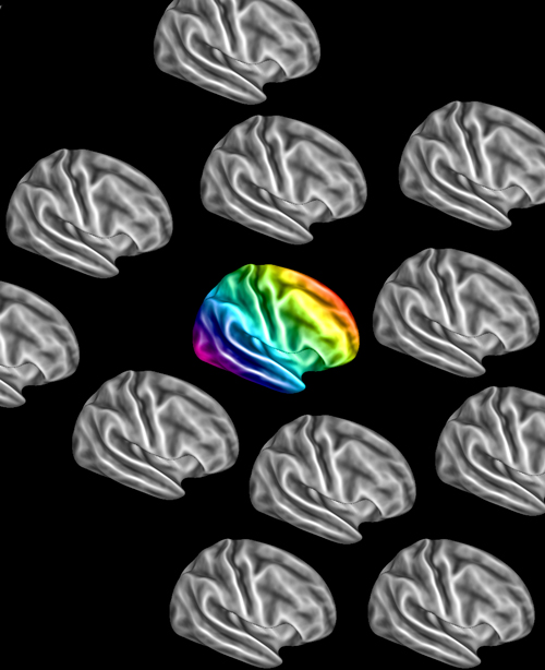 תבניות הפעילות המוחית באוטיסטים, בזמן מנוחה, שונות מהתבניות הנוצרות במוחות "רגילים"