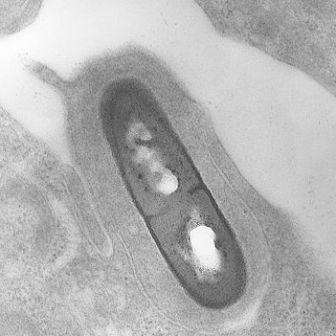 תמונת מיקרוסקופ אלקטרונים סורק של חיידק הליסטריה