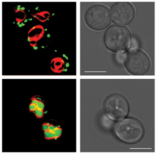 תאי שמרים כפי שהם נראים במיקרוסקופ אור (מימין) ובמיקרוסקופ פלואורסצנטי (משמאל). כאשר רמת המזון של התאים סבירה (שורה עליונה), החלבונים של אברוני הגולג'י (נקודות ירוקות) מסודרים באופן תקין, מחוץ לגופי המיחזור של התא (אדום). כאשר התאים מורעבים (שורה תחתונה), חלבוני הגולג'י נכנסים באופן לא תקין לגופי המיחזור, שם הם מפורקים