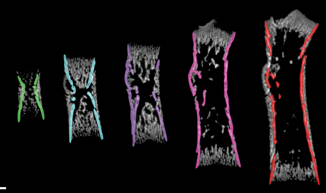 עצמות עכברים בגילאים שונים אשר נסרקו בטומוגרפיה ממוחשבת בתלת-מימד. מבנה-מפתח במרכז העצם (מודגש בצבעים שונים) איפשר למדענים לבצע החפפה בין העצמות ולהשוות ביניהן