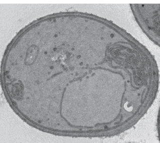 תא שמרים מהונדס שלא נוצרות בו טיפות ליפידים, כפי שהוא נראה במיקרוסקופ אלקטרוני. לאחר חשיפה לתנאי עקה מסוימים, אברון הקרוי רטיקולום אנדופלאסמי (למעלה מימין) נראה מוגדל מעבר לרגיל, דבר המצביע על הקשר בין הטיפות לבין אברון זה