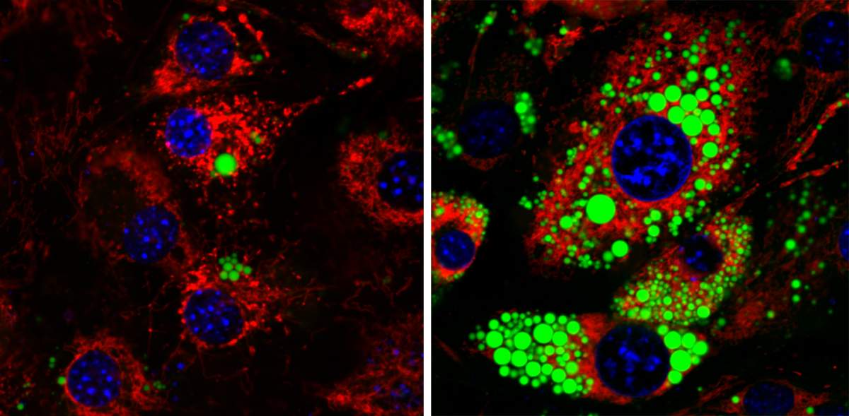 Fat cells lacking Mitch (left) have fewer fat drops (green) than regular fat cells (right)