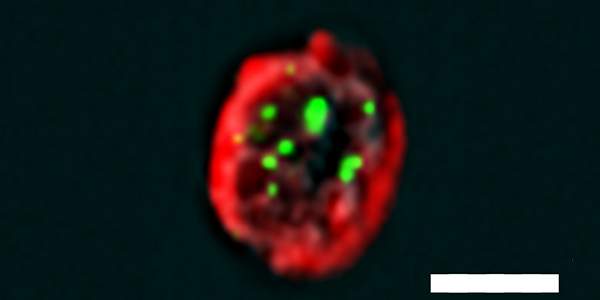 "סלפי" תאי: תא mTEC אשר צולם באמצעות השיטה החדשה הקרויה PLIC. הנקודות הירוקות מצביעות על אינטראקציה בין חלבונים העוזרת למנוע מתקפה אוטואימונית