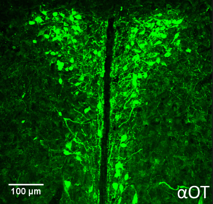 תאי עצב המייצרים אוקסיטוצין בגרעין הפאראוונטריקולרי (PVN) בהיפותלמוס של עכברים
