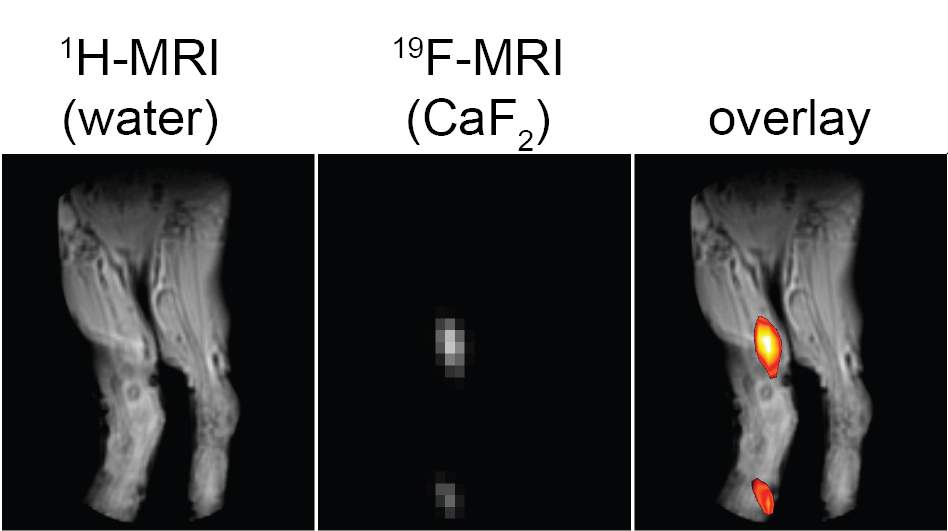 שימוש בסידן פלואורי בתור חומר סימון מאפשר לגלות סימני דלקת שאינם נראים בסריקות MRI רגילות