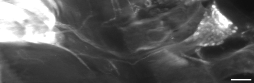 The sensory nerve cells revealed in the study extend their long fibers from the mouse’s spine (right) into brown fat tissues (left)