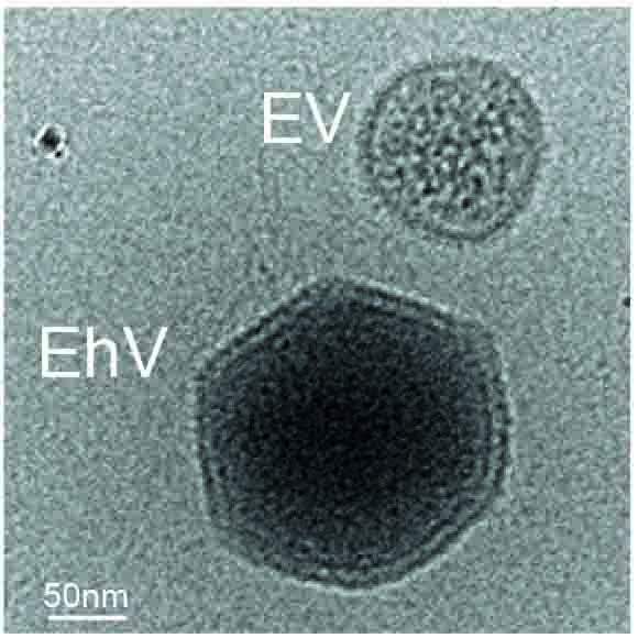 הווירוס (EhV) והבועית (EV) במיקרוסקופ אלקטרונים קריוגני