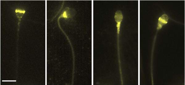 ​ מיקומם השונה של אופסינים שונים על תא זרע של אדם, כפי שהם נראים תחת מיקרוסקופ, התגלה באמצעות סימון בנוגדן פלואורסצנטי (בצהוב בוהק)