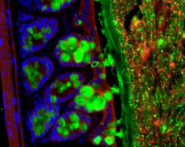 Bacteria (red) in mouse large intestine; intestinal cells (blue); and secretion of mucus from goblet cells (green), which protect the intestines and preventing direct contact between the bacteria and the sterile mouse cells, photographed under a fluorescent microscope 