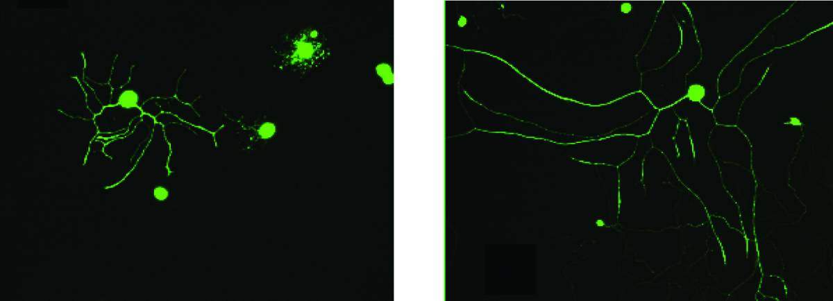 כאשר חסר בתאי עצב של עכבר החלבון אימפורטין-בטא-1, מתעוות "הדימוי העצמי" בתאים, והם מצמיחים שלוחות ארוכות יותר (מימין) בהשוואה למצב הרגיל (משמאל). צולם באמצעות מיקרוסקופ פלואורסנציה אוטומטי