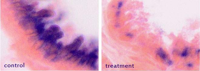 Elimination of senescent cells from the lung: Mice were treated with the drug that eliminates senescent cells (blue) or with a control solution. The drug treatment (right) efficiently eliminated senescent cells