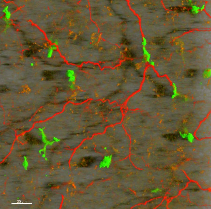 מקרופאגים (בירוק) ואקסונים (באדום) ברקמת שומן חום. צולם באמצעות מיקרוסקופיה דו-פוטונית