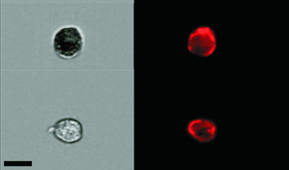 תאים מזדקנים (למעלה) ותאים רגילים (למטה) מהרירית הפנימית של ריאת עכבר, צבועים בצבעים המבליטים את סממני ההזדקנות (משמאל) או את מאפייני הרירית (ימין). צולם בעזרת טכנולוגיית ImageStreamX 