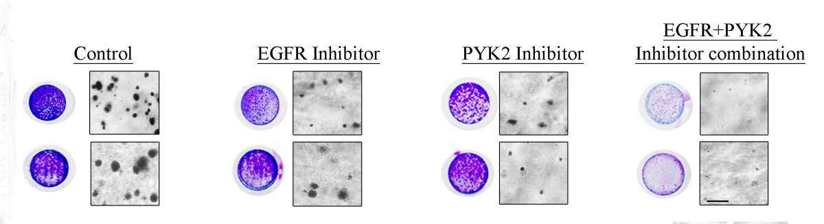 הטיפול המשולב (מימין) עיכב באופן ניכר את גידול התאים הסרטניים (נקודות שחורות/סגולות), בהשוואה לטיפול המבוסס על דיכוי מולקולה אחת בלבד