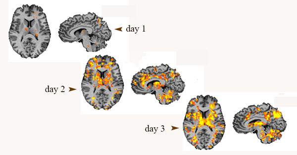 Brain imaging with fMRI reveals increased neuronal connectivity (yellow and orange), reinforced by neurofeedback, on days 2 and 3 of the study. Critically, participants were unaware that a training process was taking place