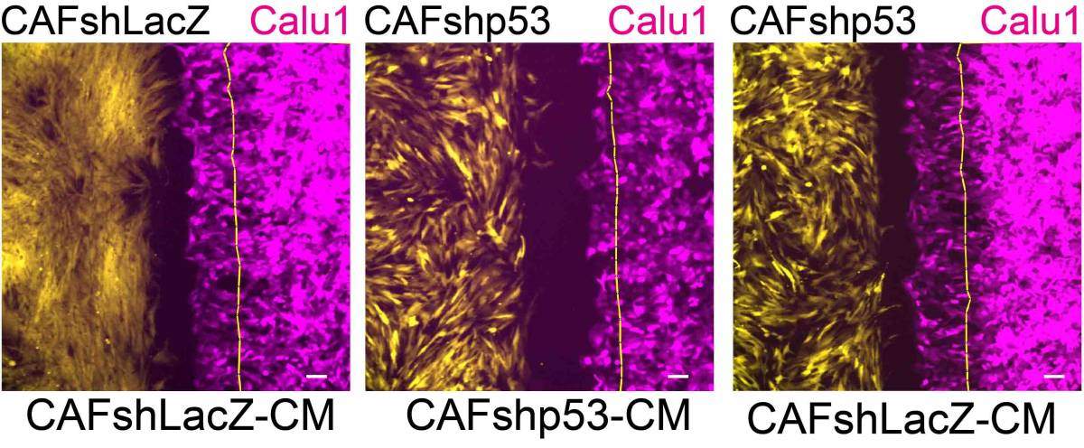השפעת ה-p53 בתאי פיברובלסט על נדידת תאי סרטן: תאים סרטניים (אדום מגנטה) נודדים לכיוון פיברובלסטים תומכי סרטן (צהוב) המבטאים את הגן p53 (שמאל); הנדידה פוחתת (מרכז) כאשר מושתק ה-p53 בפיברובלסטים; כאשר מוסיפים לתרבית התאים חומרים שמפרישים הפיברובלסטים תומכי הסרטן, חוזרת הנדידה לאיתנה (ימין)