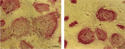 Colonies of mouse embryonic stem cells, viewed with a microscope: the cells differentiated properly when their genome contained an intact copy of the p53 gene (left), but not when the p53 was missing (right)