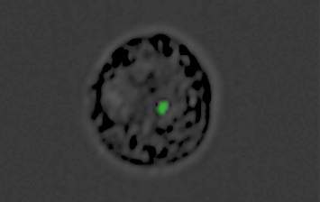 תא המונוציט אשר הפך לפיתיון. הנקודה הירוקה – המטען הגנטי שנשלח בתוך בועית מטפיל המלריה לתאי המערכת החיסונית