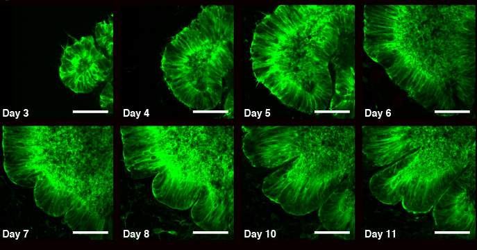 11 ימים במעבדה: התפתחות אורגנואיד המוח והופעת הקפלים החל בשבוע השני 
