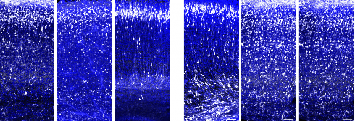 נדידת תאי העצב במוח של עוברי עכברים: במצב רגיל נודדים תאים רבים (נקודות לבנות) לשכבה העליונה של קליפת המוח (שלוש תמונות משמאל), אך בהיעדרו של החלבון 3C נותרו התאים פזורים לאורך מסלול הנדידה (שלוש תמונות מימין). צולם באמצעות מיקרוסקופ קונפוקלי