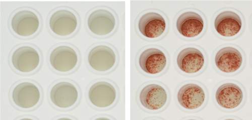 צלוחיות מעבדה המכילות אלפי תאי דם לבנים מחולה שפיתח "סובלנות חיסונית" לתורם לאחר השתלת לשד עצם. התאים אינם מראים סימני דחייה של תאי התורם (שלושה טורים משמאל), אך מפרישים כימיקלים המעידים על דחייה (מסומנים באדום) עם חשיפתם לתאים של אדם שלישי (שלושה טורים מימין)