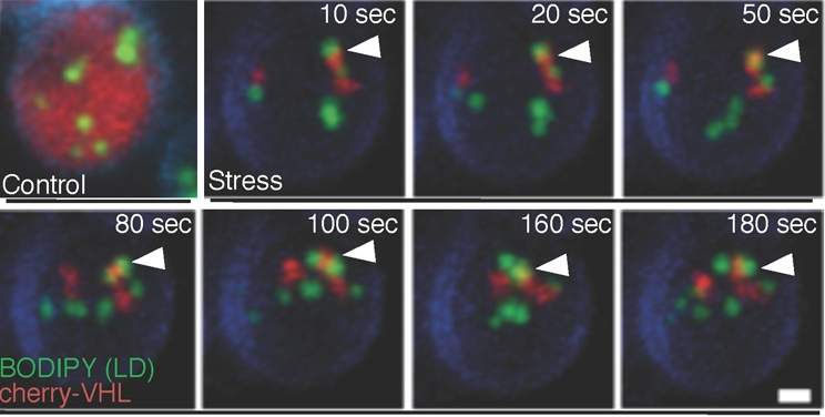 Inclusion bodies (red) and lipid droplets (green) are tethered in the yeast cell, as can be seen by tracking their joint movement over time