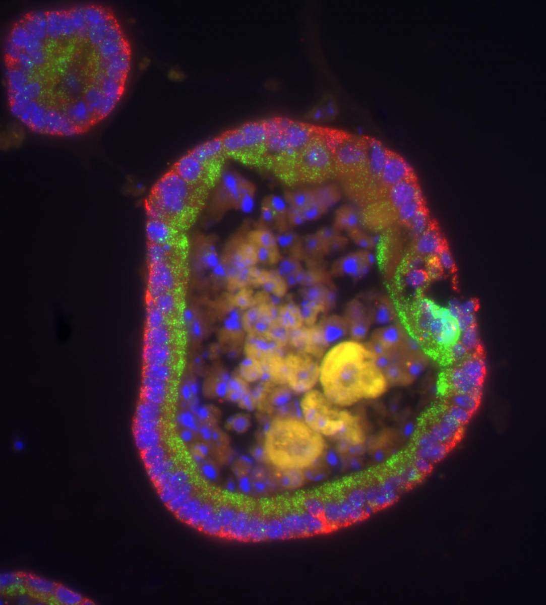 מבנה תאי עגול בגודל כ-0.5 מילימטר, אשר מחקה במבחנה את חתך המעי. בשכבתו העליונה ממוקמות מולקולות אר-אן-אי שליח של שני גנים שונים (אדום וירוק) בשני צידי הגרעין של התאים (כחול)