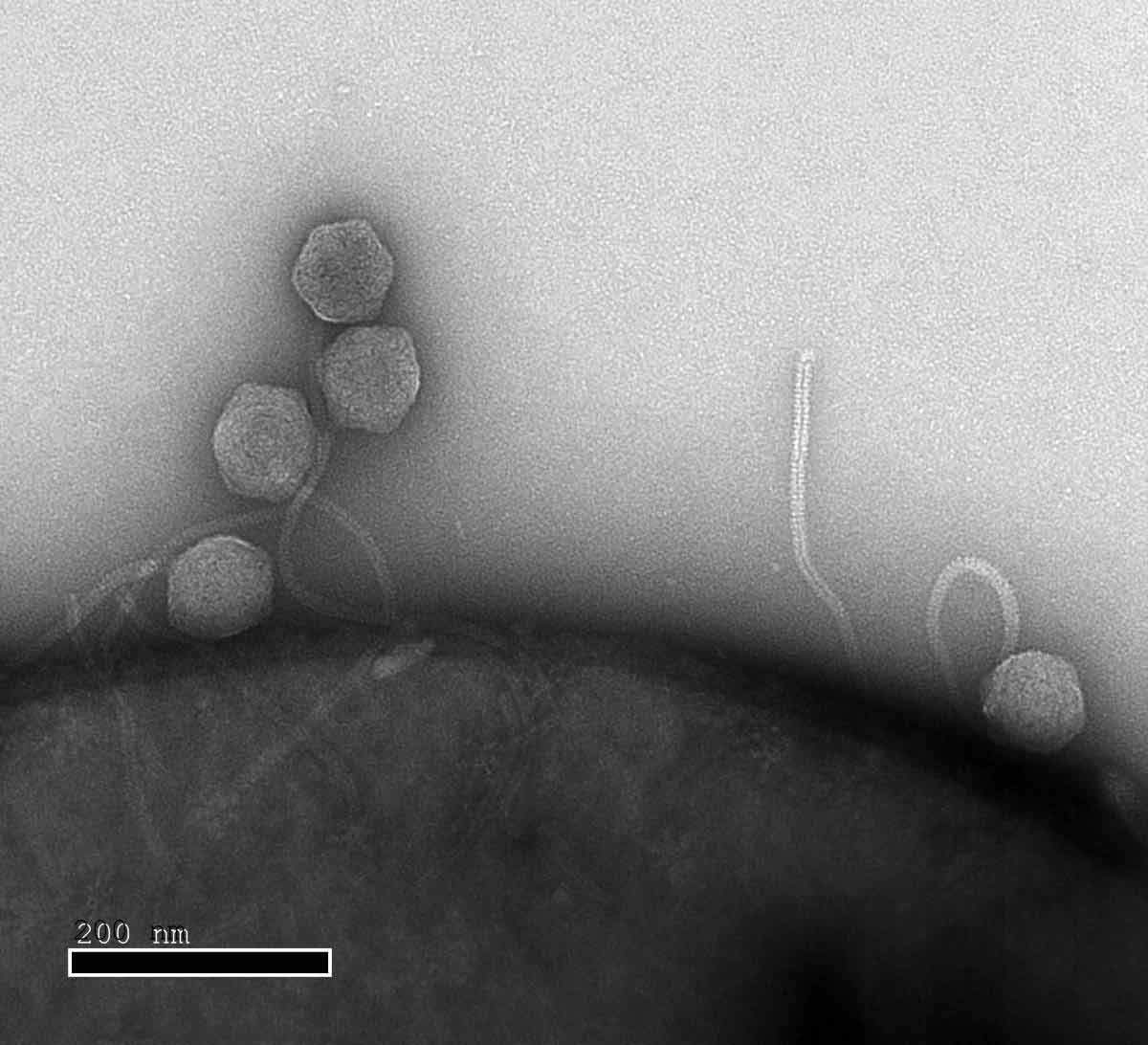 Close up: phages infecting an E. coli 