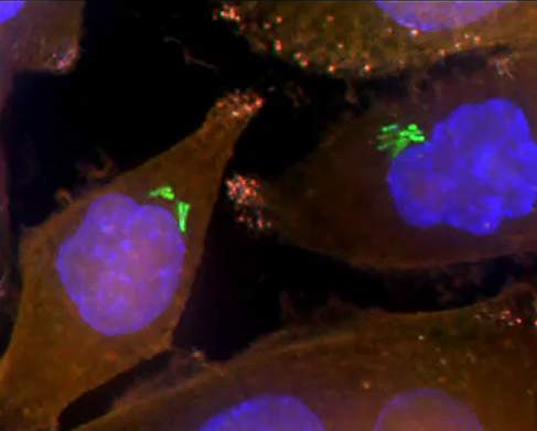 חיידקים (בירוק) בתוך תאי סרטן הלבלב (תאי AsPC-1). הגרעינים של התאים צבועים בכחול והנוזל התוך-תאי בכתום