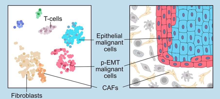 ריצוף אר-אן-איי של תאים בודדים מאפשר למפות את המערכת האקולוגית של תאי הסרטן. התאים הסרטניים שנמצאים בתהליך הפיכה לתאים אחרים (באדום) מצויים בשוליים החיצוניים של הגידול