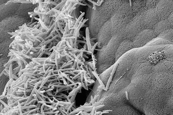 תאי העכבר ולצדם חיידקי המעיים, שנראים כחוטים. צולם באמצעות מיקרוסקופ אלקטרונים