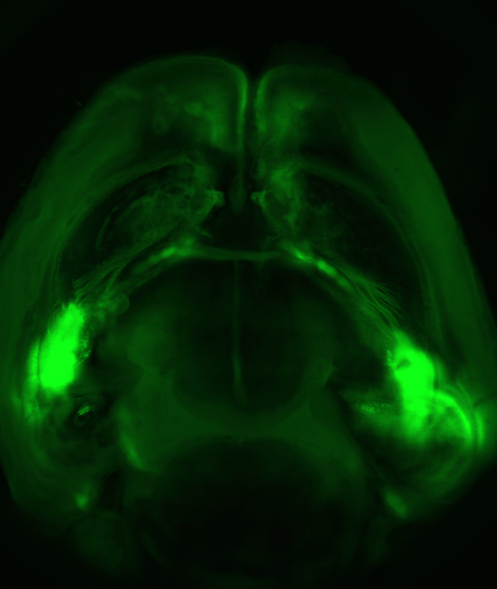 מוח עכבר במבט מלמעלה: שלוחות עצביות מחברות בין שתי האמיגדלות (שני האזורים הבוהקים ביותר, משני צידי המוח) לבין קליפת המוח (החלק העליון)