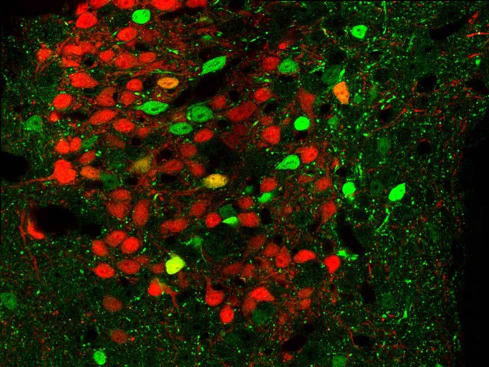 פרוסת מוח של עכבר מהונדס גנטית. תאי עצב שמבטאים את הקולטן CRFR1 מופיעים בירוק, ותאי העצב שמבטאים את המוליך העצבי CRF מופיעים באדום. התמונה צולמה במיקרוסקופ פלואורוסנטי 