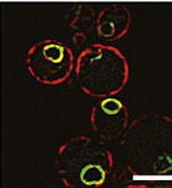 צילום פלורסנטי של תאי שמרים, המראה שחלבון השמרים Ypf1 (בירוק) מצוי מסביב לגרעין התא, בדומה לפרסנילין, החלבון האנושי המקביל לו, שגורם למחלת אלצהיימר