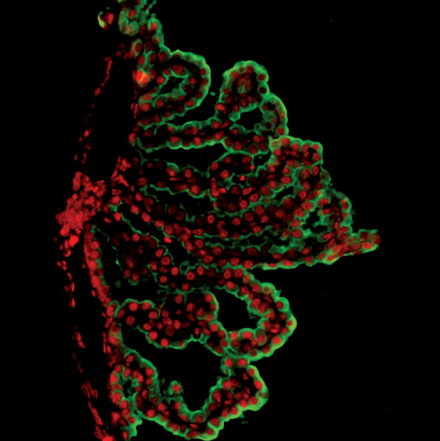 צילום באמצעות מיקרוסקופ אימונו-פלורסנטי של אפיתל מקלעת הדמים, הממוקם בחדרי המוח. אפיתל מקלעת הדמים משמש כממשק חיסוני בין הדם לבין המוח, ומשפיע על הפעילות המוחית לאורך החיים. בירוק: תאי האפיתל; באדום: חלבוני כימוקין בשם CXCL10
