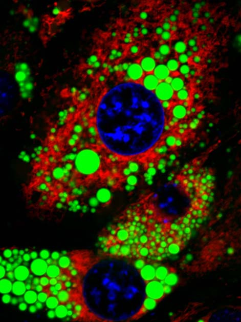 Fat cells