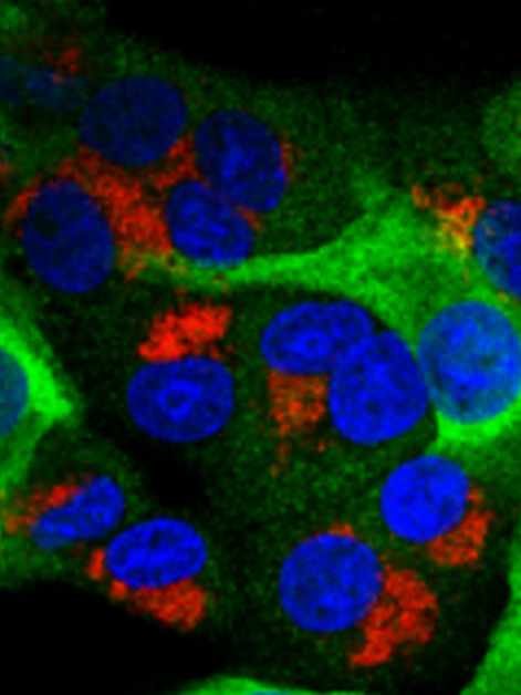 SARS-CoV-2 infected cells