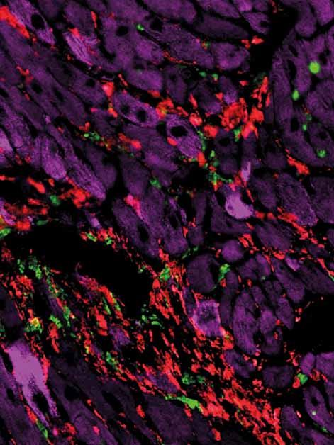 Mouse heart tissue viewed under a microscope