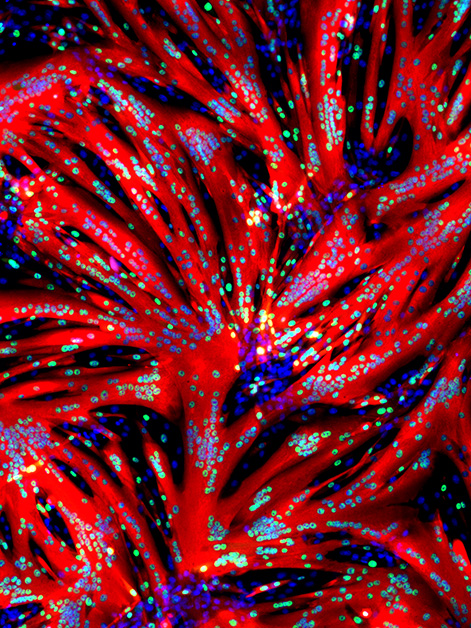 המראה המפתיע שהתגלה מבעד לעינית המיקרוסקופ: תאי גזע של שריר שמקורם בעכברים עברו תהליך מהיר של איחוי ויצירת סיבי שריר (באדום) מרובי גרעינים (הנקודות הכחולות) לאחר שנחשפו במשך 24 שעות למולקולה החוסמת את האנזים ERK // ד"ר תמר איגלר, מעבדת המחקר של פרופ' אלדד צחור