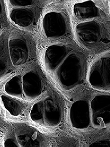 המרקם הבין-תאי במעי תחת מיקרוסקופ אלקטרונים סורק