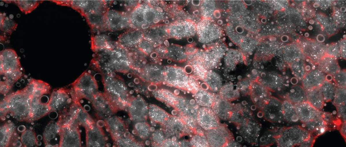 אוניית כבד של עכבר. צולם במיקרוסקופ פלואורסצנטי. השכבה האמצעית מכילה מולקולות רבות של אר-אן-אי שליח (נקודות לבנות) המקודדות את החלבון הפצידין, אשר מווסת את רמות הברזל בדם