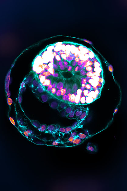 A stem cell–derived human embryo model at a developmental stage equivalent to that of a human embryo at day 12 has all the compartments typical of this stage. The top sphere contains the part that will become the embryo itself, capped by the amnion; the bottom sphere is the yolk sac; the interface between them is a critical structural feature of human embryonic development. The two spheres are encapsulated by a cellular layer that will become the placenta