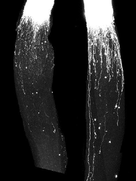 Overexpression of genes from the B2-SINE family in retinal ganglion neurons led to accelerated growth after injury