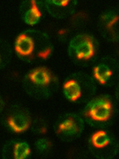 מיטוכונדריה (אדום) המתאספות סביב גרעין התא (ירוק) כפי שנצפה תחת מיקרוסקופ פלואורסצנטי 