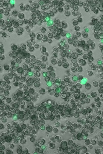 Lung macrophages infected with the human cytomegalovirus. Cells harboring an active infection are in bright green