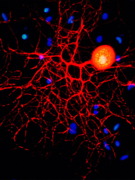 תמונת מיקרוסקופיה קונפוקלית של תאי עצב תחושתיים של מערכת העצבים ההיקפית בתרבית 