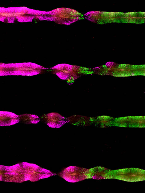 Researchers used color-coded proteins to reveal the identity of the cells in the organoids they produced. In four organoids that simulate the embryo’s central nervous system, the magenta marks proteins associated with the development of the forebrain and the midbrain, the green, the hindbrain and the red, the center of the spinal cord