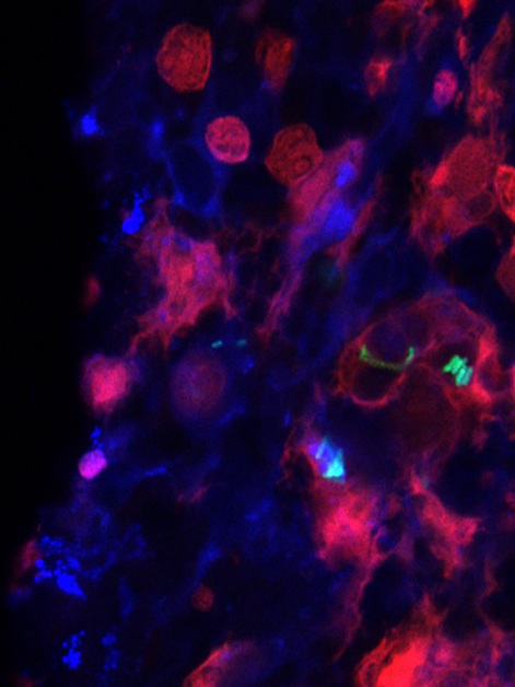 צילום מיקרוסקופי פלואורסצנטי של חיידקי סלמונלה (ירוק) שנבלעו על-ידי תאים מקרופאגים (אדום) שמקורם בטחול העכבר (בכחול – גרעיני התאים)