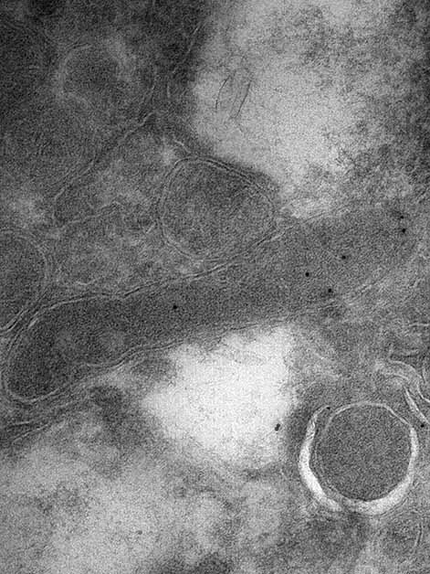 A bacterial cell (elongated shape in the center) inside a glioblastoma tumor cell, as seen through an electron microscope. The black dots within the bacterium are engineered antibodies carrying gold particles that bind specifically to a component found only in bacterial cell envelopes and not in human cells