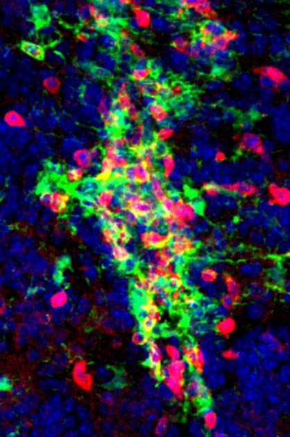 מקבצים של תאי מיקרוגליה (בירוק) ותאי T (באדום) במוח עכבר עם מחלה דמוית טרשת נפוצה